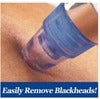 Blackhead Remover Vacuum — Pore Cleansing Suction Tool